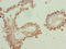 Zinc Finger Protein 184 antibody, LS-C377034, Lifespan Biosciences, Immunohistochemistry paraffin image 