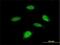 Ribosomal Protein S6 Kinase B2 antibody, H00006199-M08, Novus Biologicals, Immunocytochemistry image 