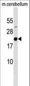 MAF BZIP Transcription Factor G antibody, LS-C158092, Lifespan Biosciences, Western Blot image 