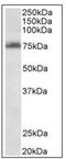 TSPY Like 2 antibody, AP31845PU-N, Origene, Western Blot image 