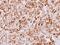 STIP1 Homology And U-Box Containing Protein 1 antibody, PA5-29024, Invitrogen Antibodies, Immunohistochemistry paraffin image 