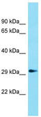 Glycerophosphodiester phosphodiesterase domain-containing protein 1 antibody, TA332227, Origene, Western Blot image 