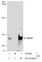 Adenosine Deaminase RNA Specific antibody, GTX101602, GeneTex, Immunoprecipitation image 