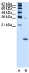 Hemoglobin Subunit Zeta antibody, TA346403, Origene, Western Blot image 