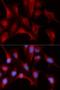 Proteasome Subunit Beta 4 antibody, LS-C334227, Lifespan Biosciences, Immunofluorescence image 