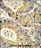 Ribosomal Protein S18 antibody, GTX81669, GeneTex, Immunohistochemistry paraffin image 