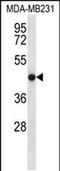 Transmembrane Protein 43 antibody, PA5-48409, Invitrogen Antibodies, Western Blot image 