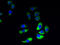 GRAM Domain Containing 1B antibody, A64934-100, Epigentek, Immunofluorescence image 