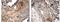 Bone Morphogenetic Protein Receptor Type 1A antibody, GTX52504, GeneTex, Immunohistochemistry paraffin image 