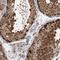 COP9 Signalosome Subunit 7B antibody, NBP2-38214, Novus Biologicals, Immunohistochemistry frozen image 