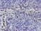 Peptidyl Arginine Deiminase 4 antibody, MA5-26006, Invitrogen Antibodies, Immunohistochemistry paraffin image 