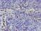 Peptidyl Arginine Deiminase 4 antibody, MA5-26006, Invitrogen Antibodies, Immunohistochemistry paraffin image 