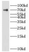 Kelch Like Family Member 15 antibody, FNab04615, FineTest, Western Blot image 