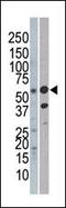 REL Proto-Oncogene, NF-KB Subunit antibody, PA5-13356, Invitrogen Antibodies, Western Blot image 