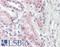 Nephrocystin 4 antibody, LS-B8569, Lifespan Biosciences, Immunohistochemistry paraffin image 