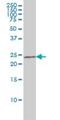 CASP2 And RIPK1 Domain Containing Adaptor With Death Domain antibody, H00008738-M01, Novus Biologicals, Western Blot image 