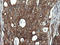 DExD/H-Box Helicase 58 antibody, LS-C174703, Lifespan Biosciences, Immunohistochemistry paraffin image 