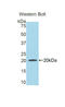 Hemopexin antibody, LS-C294460, Lifespan Biosciences, Western Blot image 