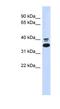 Epoxide Hydrolase 4 antibody, NBP1-62668, Novus Biologicals, Western Blot image 