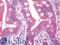 DIMT1 RRNA Methyltransferase And Ribosome Maturation Factor antibody, LS-B10564, Lifespan Biosciences, Immunohistochemistry paraffin image 