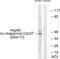 Cell Division Cycle 37 antibody, LS-C198780, Lifespan Biosciences, Western Blot image 