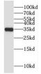 Glycine-N-Acyltransferase Like 1 antibody, FNab03507, FineTest, Western Blot image 