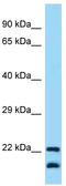 CD200 Molecule antibody, TA343315, Origene, Western Blot image 