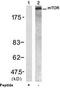 Serine/threonine-protein kinase mTOR antibody, TA310067, Origene, Western Blot image 