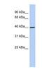 DNA Damage Inducible 1 Homolog 1 antibody, NBP1-56817, Novus Biologicals, Western Blot image 