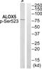 Arachidonate 5-Lipoxygenase antibody, PA5-39830, Invitrogen Antibodies, Western Blot image 