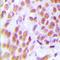Zinc Finger RANBP2-Type Containing 2 antibody, LS-C368650, Lifespan Biosciences, Immunohistochemistry frozen image 