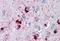 Crystallin Alpha B antibody, MBS243644, MyBioSource, Immunohistochemistry paraffin image 