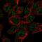 ATP Binding Cassette Subfamily G Member 5 antibody, PA5-53439, Invitrogen Antibodies, Immunofluorescence image 