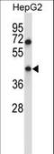 Vacuole Membrane Protein 1 antibody, LS-C162013, Lifespan Biosciences, Western Blot image 