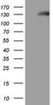 Natriuretic Peptide Receptor 1 antibody, TA805600, Origene, Western Blot image 