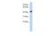 Retinol Dehydrogenase 16 antibody, PA5-42115, Invitrogen Antibodies, Western Blot image 
