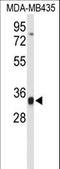 TCF3 Fusion Partner antibody, LS-C161822, Lifespan Biosciences, Western Blot image 