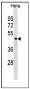 N-Myc Downstream Regulated 1 antibody, AP51320PU-N, Origene, Western Blot image 