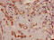 Tribbles Pseudokinase 2 antibody, LS-C670272, Lifespan Biosciences, Immunohistochemistry paraffin image 