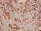 Tribbles homolog 2 antibody, LS-C670272, Lifespan Biosciences, Immunohistochemistry paraffin image 