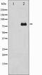 Protein Kinase C Delta antibody, TA327883, Origene, Western Blot image 