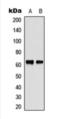 Checkpoint Kinase 2 antibody, orb393244, Biorbyt, Western Blot image 