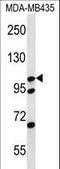 Catenin Delta 2 antibody, LS-C167134, Lifespan Biosciences, Western Blot image 