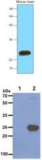 Synaptosome Associated Protein 25 antibody, MBS200064, MyBioSource, Western Blot image 