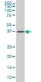 Fc Fragment Of IgM Receptor antibody, H00009214-M01, Novus Biologicals, Western Blot image 