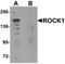 Rho Associated Coiled-Coil Containing Protein Kinase 1 antibody, orb75605, Biorbyt, Western Blot image 