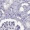 Semenogelin-1 antibody, NBP1-85425, Novus Biologicals, Immunohistochemistry paraffin image 