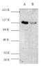 Cbl Proto-Oncogene antibody, AHP2416, Bio-Rad (formerly AbD Serotec) , Western Blot image 