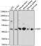 Adenosine Kinase antibody, 15-836, ProSci, Western Blot image 
