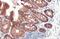 Epithelial Cell Adhesion Molecule antibody, GTX636758, GeneTex, Immunohistochemistry paraffin image 